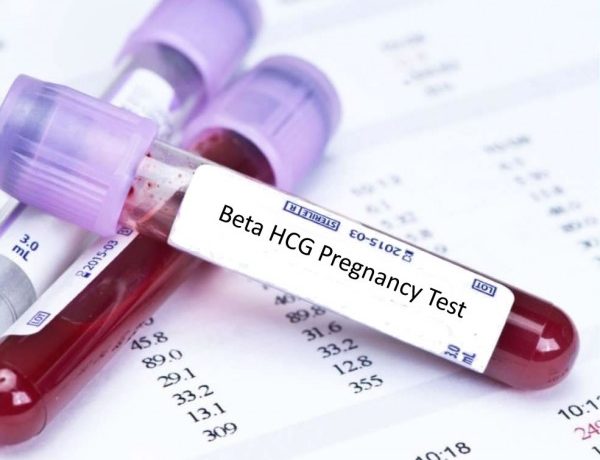 insurance In particular glass Testul beta hCG si semnificatia lui - Dr. Alina Bolintineanu