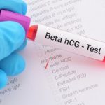 Testul beta hCG si diagnosticul de sarcina