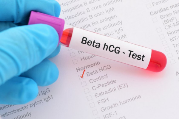 Postscript Better bush Testul beta hCG si diagnosticul de sarcina - Dr. Alina Bolintineanu