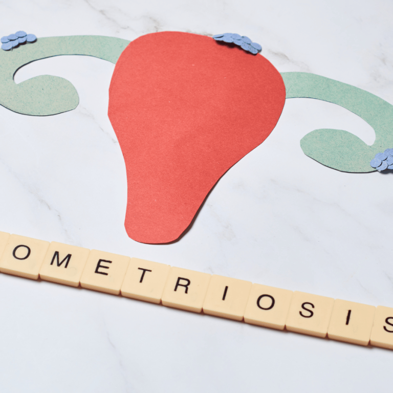 Endometrioza si Reproducerea Umana Asistata