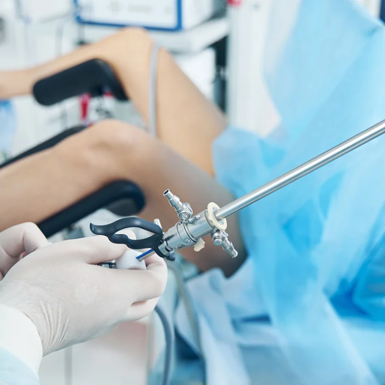 Origen_Histeroscopia_diagnostica_Topo